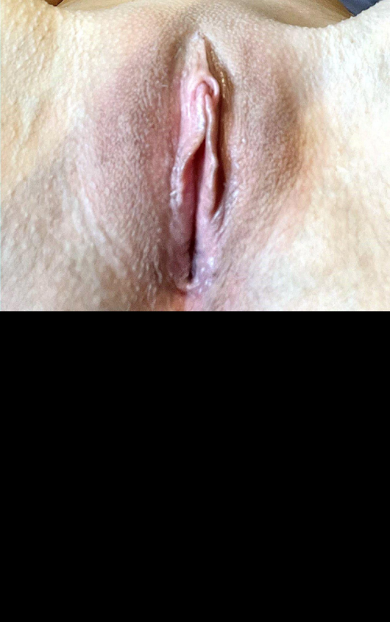 Bild 92930 von Stumpel in Kategorie Public Nude