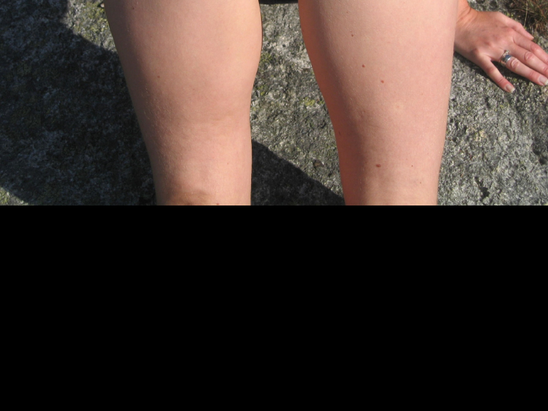 Bild 69582 von Schambereich in Kategorie Public Nude