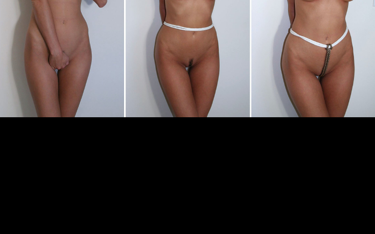 Bild 75921 von Schambereich in Kategorie BDSM
