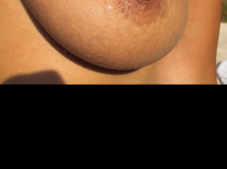 Bild 76470 von Schambereich in Kategorie Public Nude