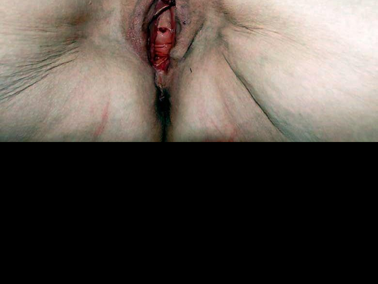 Bild 103470 von Stumpel in Kategorie Public Nude