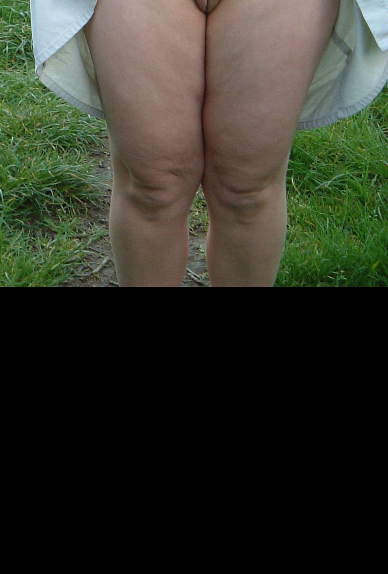 Bild 69958 von Schambereich in Kategorie Public Nude